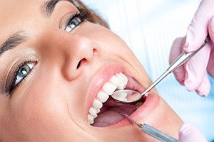 close up of dental bonding