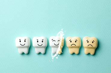 Illustration of teeth whitening in Northampton