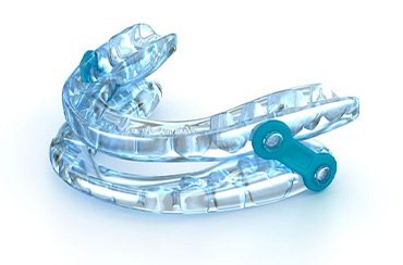 Oral appliance for sleep apnea against white background