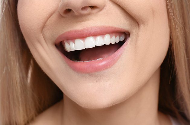 close up of smile with dental bonding