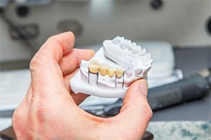 woman holding bridge on mock smile