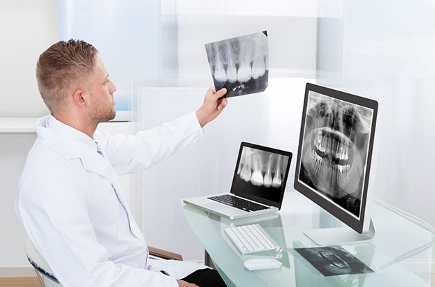Dentist looking at X-rays of accelerated dental implants in Northampton