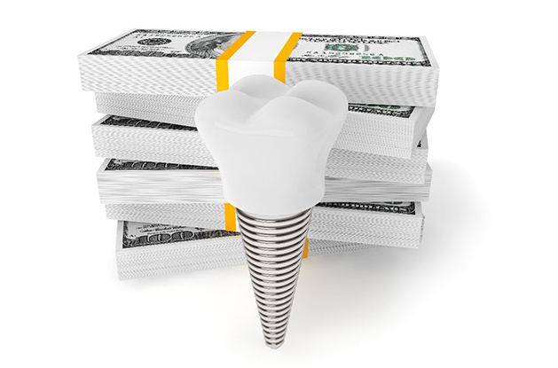 Stacks of money and model implant symbolizing the cost of dental implants in Northampton