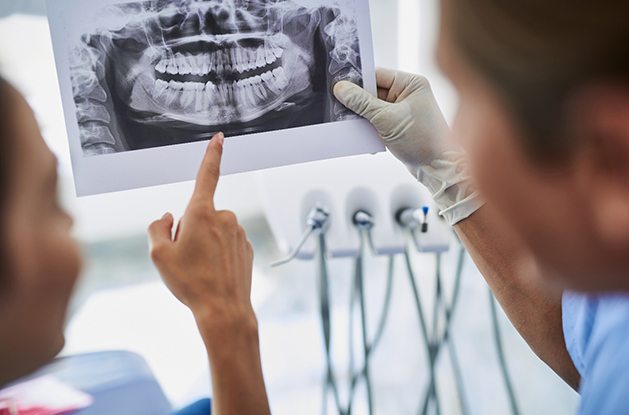 patient and dentist examining X-rays after advanced dental implant procedures