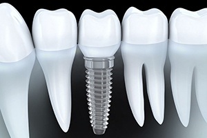 shiny implant