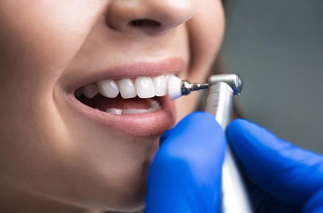 smile getting fluoride treatment