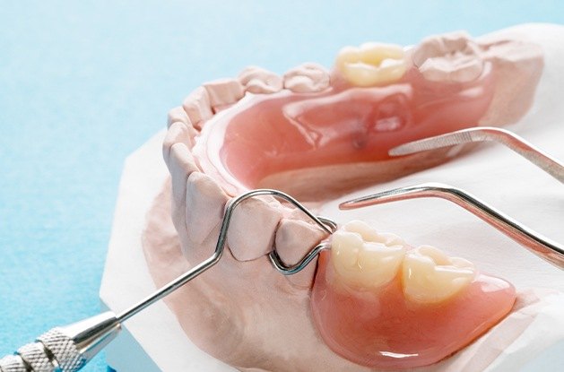 partial denture mockup