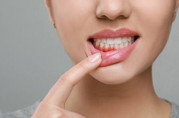a woman holding her lip down to reveal red gums