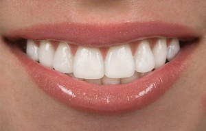 Teeth Whitening Northampton