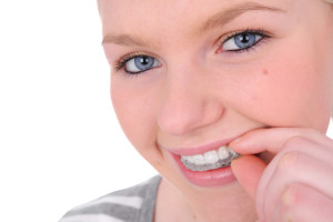 Invisalign