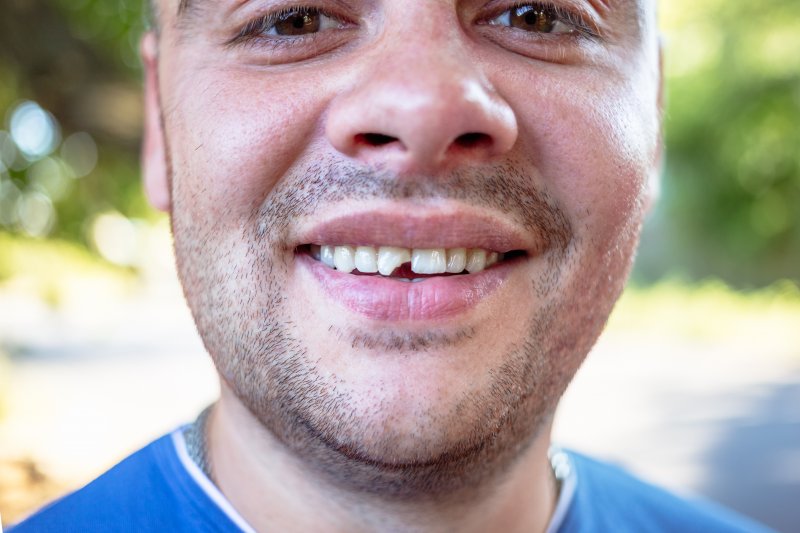 Patient with chipped tooth