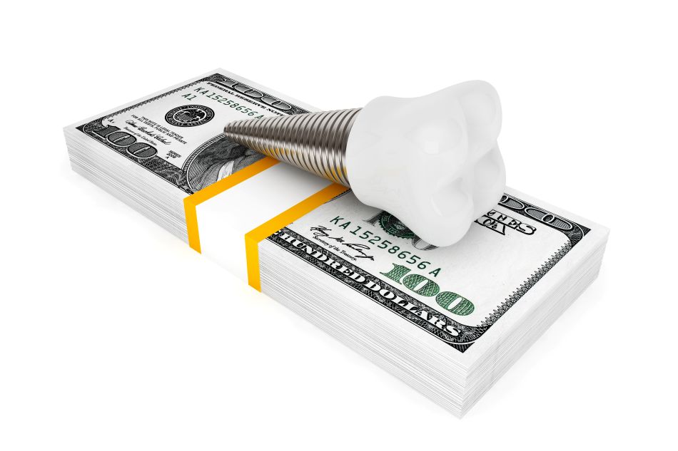 A dental implant on a stack of money.